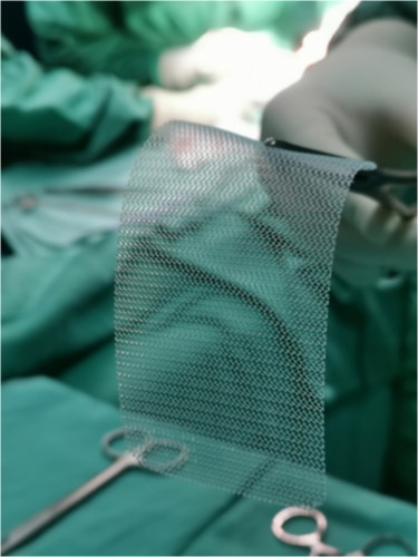 Close up of doctor in operating room holding surgical mesh with a clamp
