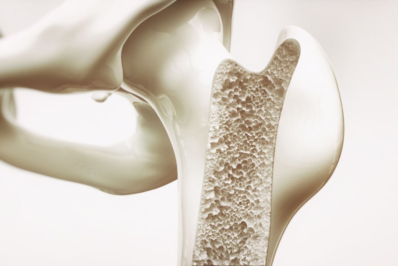 Cross section of human bone showing what osteoporosis looks like