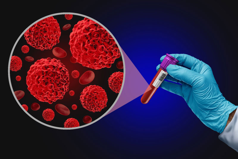 Gloved hand holding a test tube of blood with a pop up showing blood cancer cells